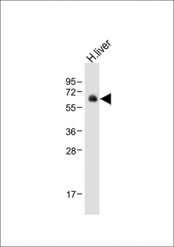 UGT2B15 Antibody (Center)