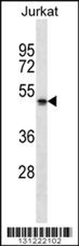 NBPF5 Antibody (C-term)