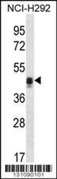 CALU Antibody (C-term)