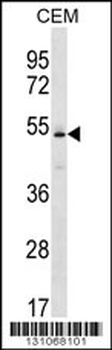 KCNJ4 Antibody (N-term)