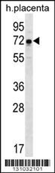 GNE Antibody (N-term)