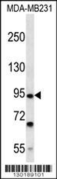 FSD2 Antibody (N-term)