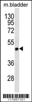 STX5 Antibody (Center)