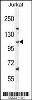 SNX25 Antibody (Center)