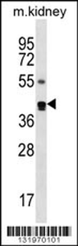 PSCD2 Antibody (N-term)
