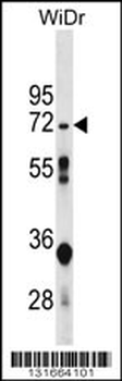 NT5C2 Antibody (N-term)