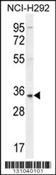 SFTPA2B Antibody (C-term)