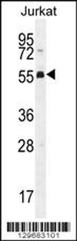PODNL1 Antibody (Center)