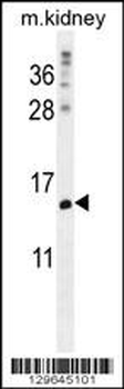MORN5 Antibody (C-term)