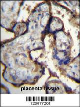ITGA5 Antibody (Center)