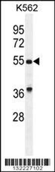 GDF9 Antibody (N-term)