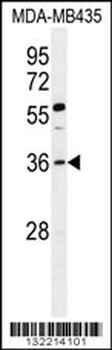 FOXE3 Antibody (Center)