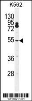 CPSF7 Antibody (C-term)
