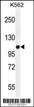 JAG1 Antibody (C-term)