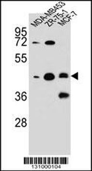 KBTBD13 Antibody (C-term)