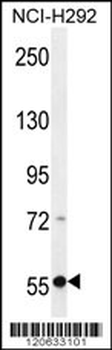 RAD26 Antibody (Center)