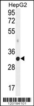 MED6 Antibody (C-term)