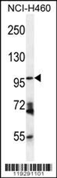 ENPEP Antibody (C-term)