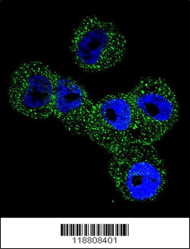 Maspin Antibody (Center)