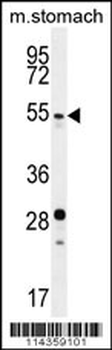 SUV4-20H2 Antibody (N-term)