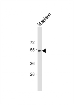 TBX6 Antibody (Center)