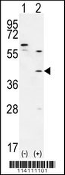 TGIF1 Antibody (Center A160)