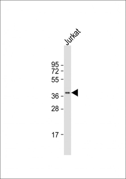 LEF1 Antibody (N-term)
