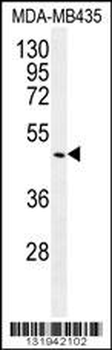GDF5 Antibody (C-term)