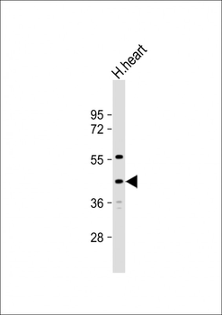 SAMD8 Antibody (N-term)