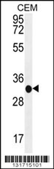 B3GAT3 Antibody (C-term)