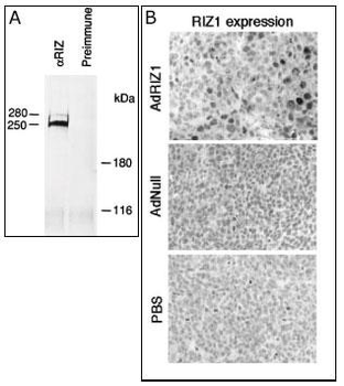 PRDM2 (RIZ1) Antibody