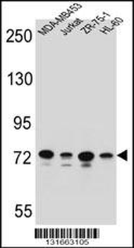 PCDHB15 Antibody (N-term)