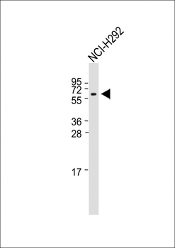 TRIM7 Antibody (N-term)