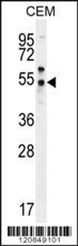 PSMAL Antibody (C-term)