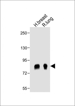 POSTN Antibody (C-term)