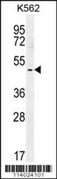 TBX6 Antibody (C-term)