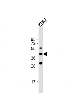 VEGF3 Antibody (N-term)