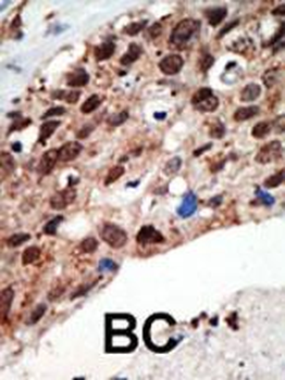 SET7 (SET9) Antibody (Center)
