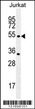 CHRNA2 Antibody (N-term)