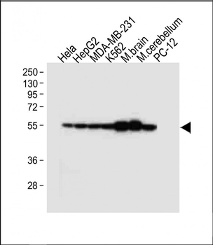 TUBB2B Antibody (N-term)