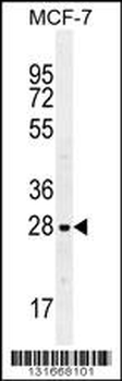 LGALS3 Antibody (C-term)