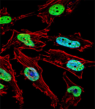 NKX1-1 Antibody (Center)