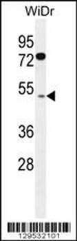 RMD1 Antibody (N-term)