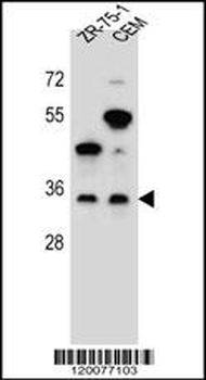 GPM6B Antibody (N-term)