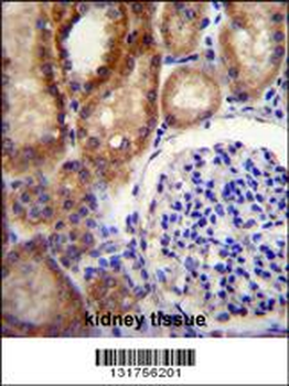 CLCN7 Antibody (C-term)