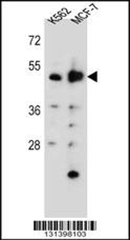 DNPEP Antibody (N-term)