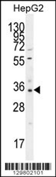 OR52I2 Antibody (C-term)