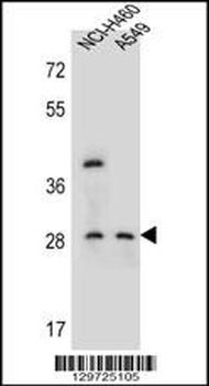 SPATS1 Antibody (Center)