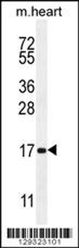SPACA5 Antibody (Center)