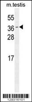 ODF3 Antibody (C-term)